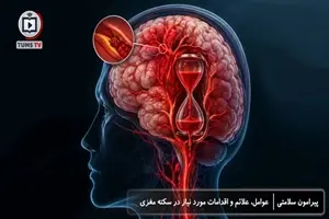 سکته مغزی، عوامل، علائم و اقدامات مورد نیاز